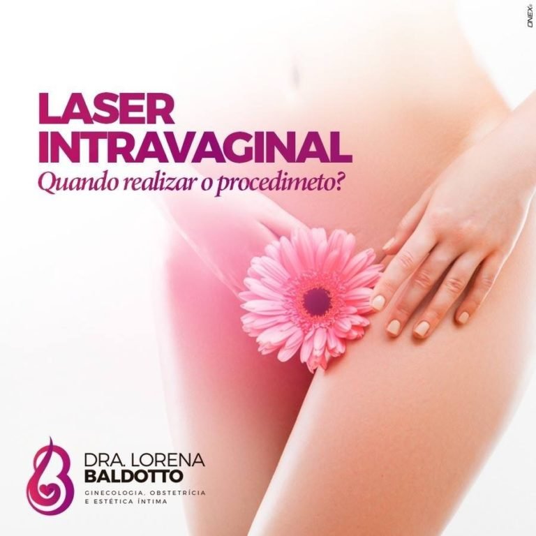 Laser intravaginal! Quando realizar o procedimento???