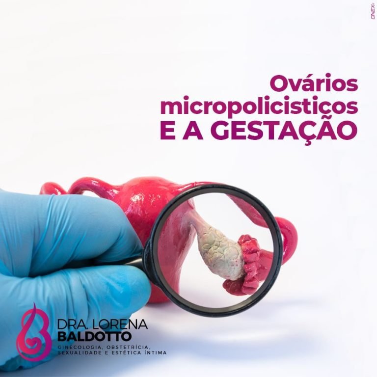 Ovários Micropolíticos e a Gestação