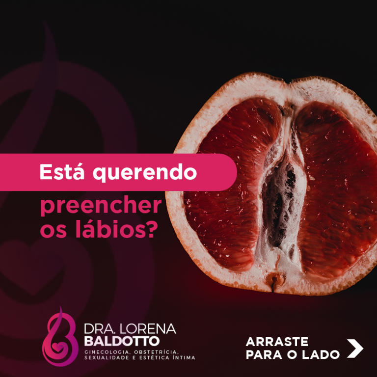 Está querendo preencher os lábios?