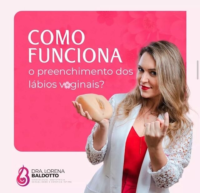 Preenchimento dos lábios íntimos 19 Preechimento dos lábios íntimos