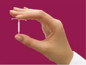 Colocação de DIU 25 procedimento-10